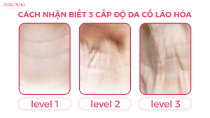 5 Thói Quen Làm Lão Hóa Vùng Cổ Bạn Nên Tránh